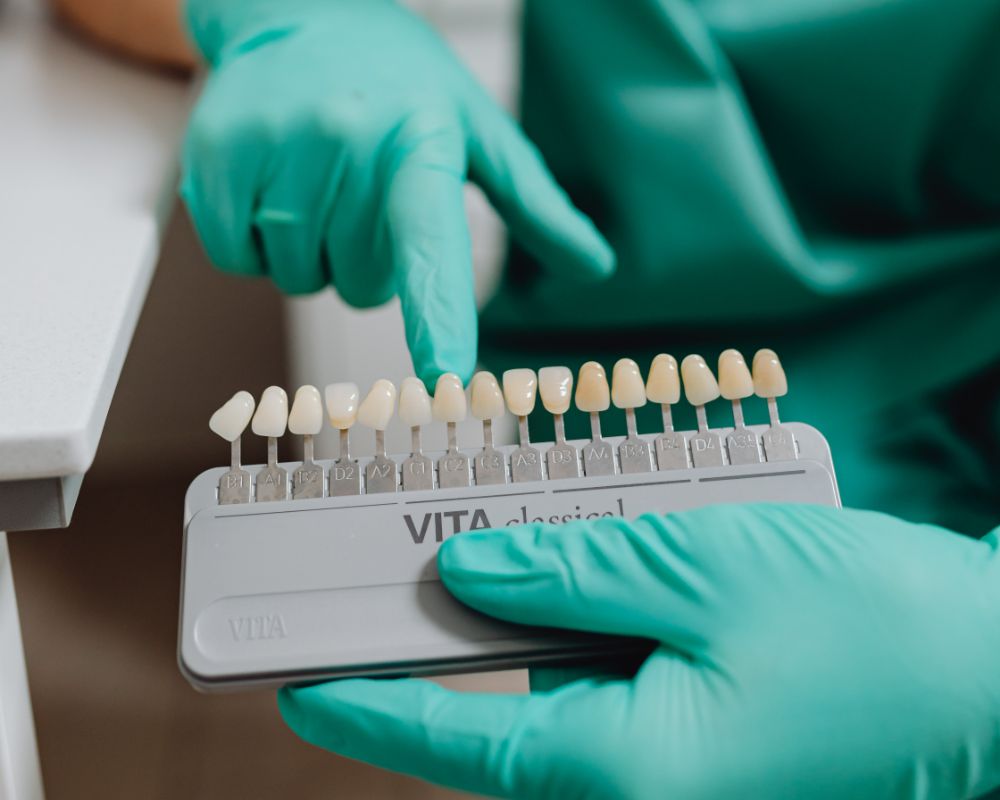 כמה זמן מחזיקה הלבנת שיניים